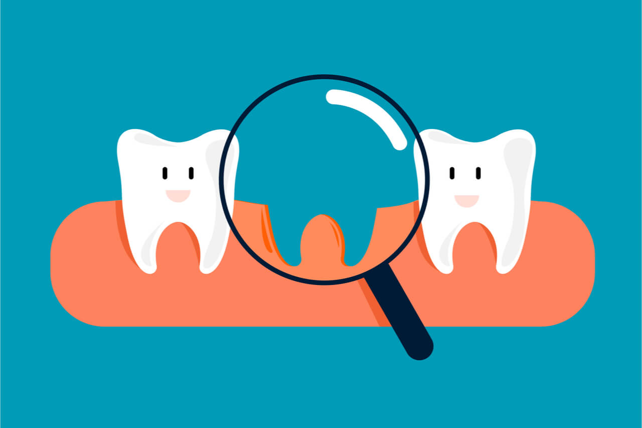 What to Do About Missing Canine TeethMy Wellness House